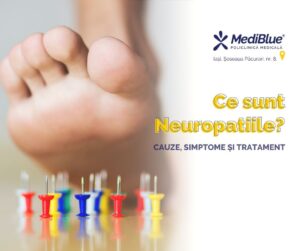 ce sunt neuropatiile