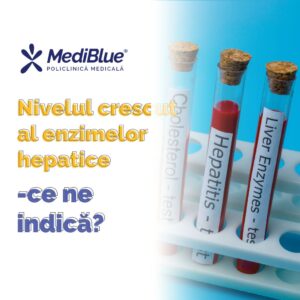Nivelul crescut al enzimelor hepatice