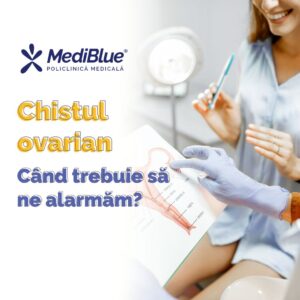 Chistul ovarian - Când trebuie să ne alarmăm?