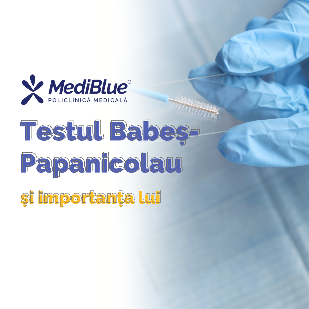 Testul Babeș-Papanicolau