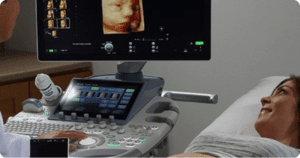 Ultrasonografie Voluson 10