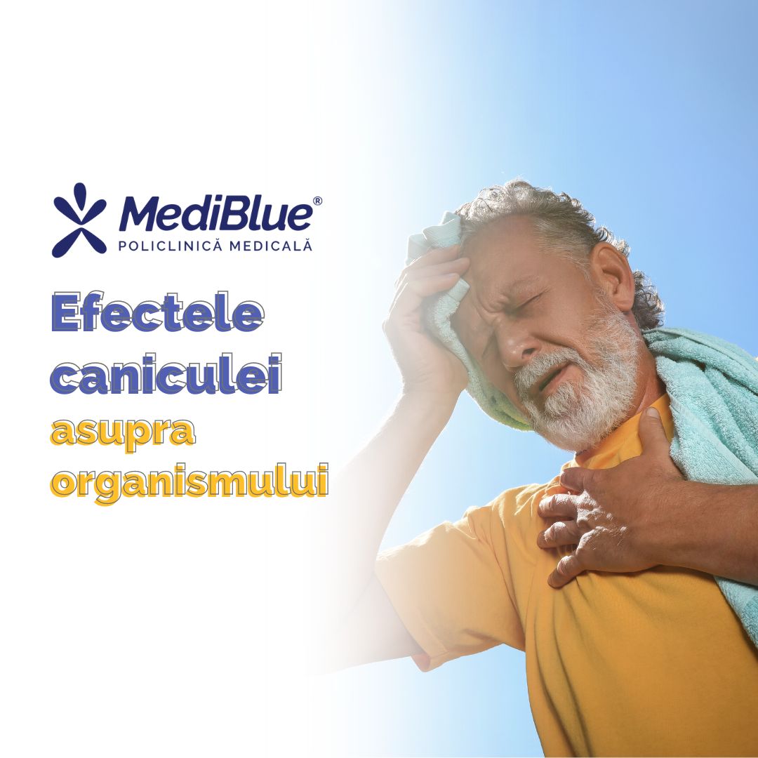 Efectele caniculei asupra organismului
