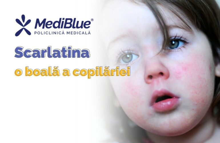 scarlatina boala copilariei