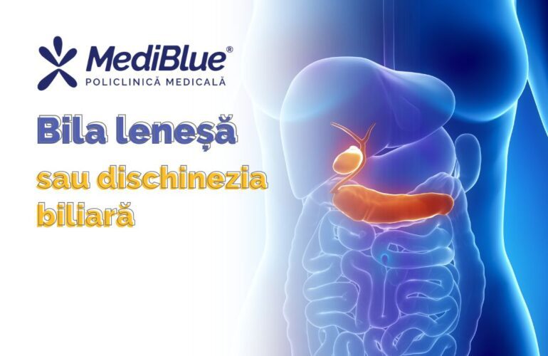 Bila Leneșă sau Dischinezia Biliară – Cauze, Simptome și Opțiuni de Tratament